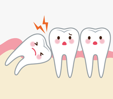 aftercare instructions for wisdom teeth removal