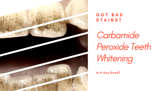 36 carbamide peroxide instructions